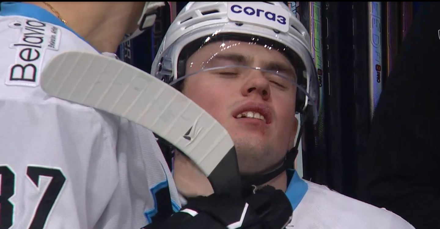 Никита Пышкайло лишился зуба в матче с «Салаватом Юлаевым»